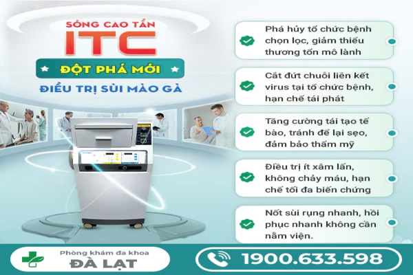 Hình ảnh minh họa